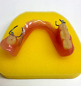 保険治療の部分床義歯（部分入れ歯）