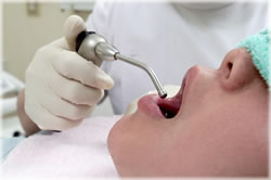 一般歯科治療とは？