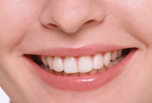 審美歯科治療とは？